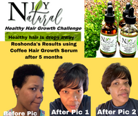 NJOY Natural Hair Growth Serum
